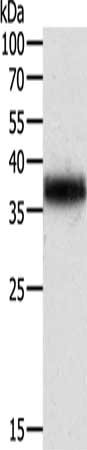 TPM2 Antibody