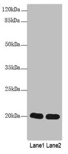 CABP5 Antibody
