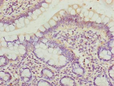 DYNLRB1 Antibody