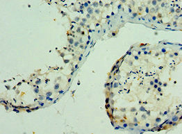PAK6 Antibody