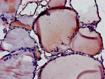 DIABLO Antibody