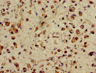 ASH1L Antibody