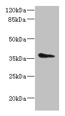 AASDHPPT Antibody