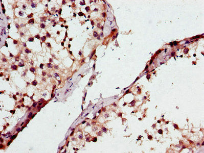 ATP8A2 Antibody
