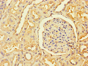 RBM12 Antibody