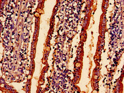 ABHD10 Antibody
