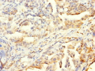 HCFC1R1 Antibody