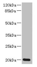ZMAT5 Antibody
