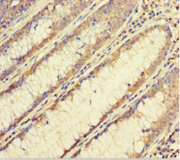 FBXL17 Antibody