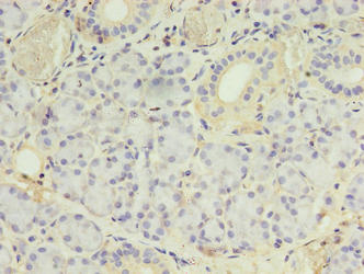 PLCD4 Antibody