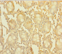 CCDC94 Antibody