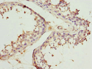 BBS2 Antibody
