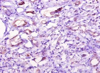 NT5C1A Antibody