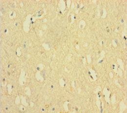 FANCD2 Antibody