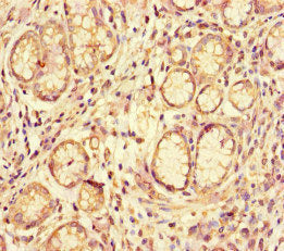 ACE2 Antibody