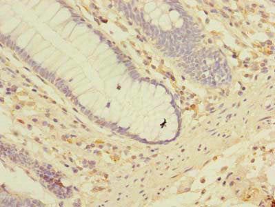 LRRC2 Antibody