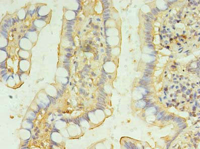 BRINP2 Antibody