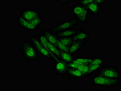 SENP6 Antibody