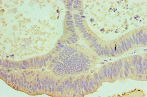 IL22 Antibody