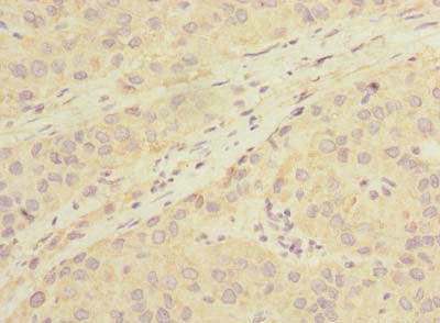 LHPP Antibody