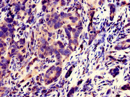 SPATC1L Antibody