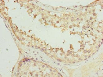PCED1A Antibody