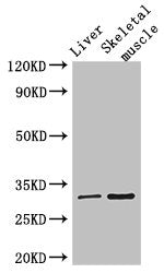 RSPH9 Antibody
