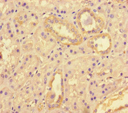 TNKS2 Antibody