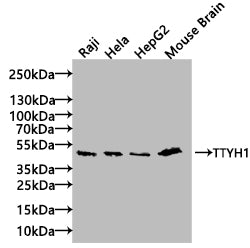 TTYH1 Antibody