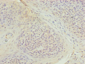TUBB1 Antibody