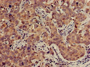 TFB2M Antibody