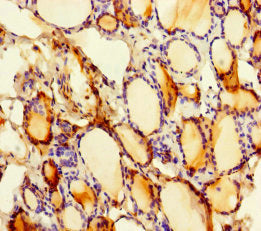 SLITRK6 Antibody