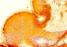 HAUS4 Antibody