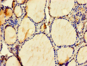 ZMAT4 Antibody
