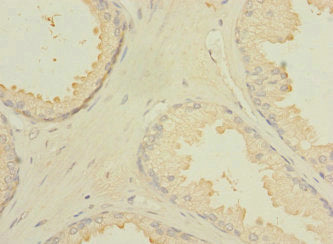 CXorf21 Antibody