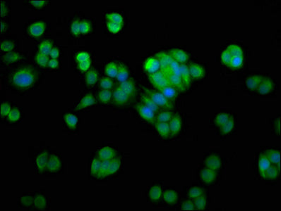 NMRAL1 Antibody