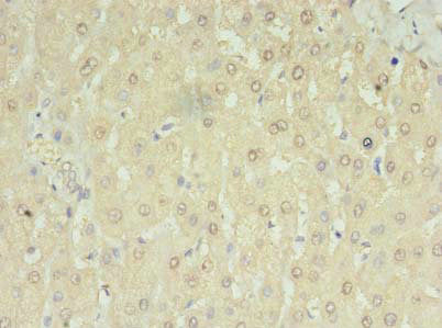 MRM3 Antibody