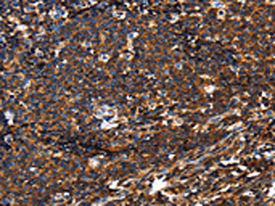PTPRC Antibody