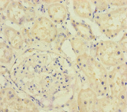 A4GALT Antibody