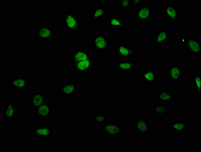 KRCC1 Antibody