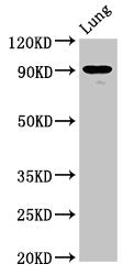 SEMA4B Antibody