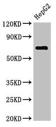 ST6GALNAC1 Antibody