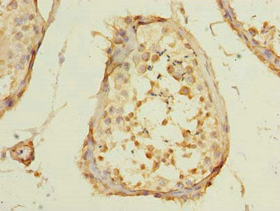 POLR3E Antibody