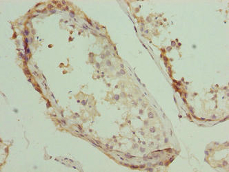 PLEKHJ1 Antibody