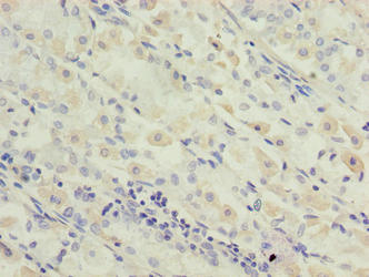 OXSM Antibody