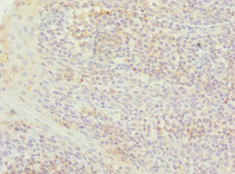 TXNL4B Antibody