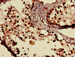 SLCO1C1 Antibody