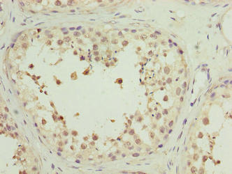 MRPL27 Antibody
