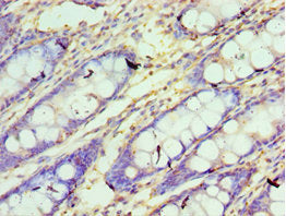 CXXC1 Antibody