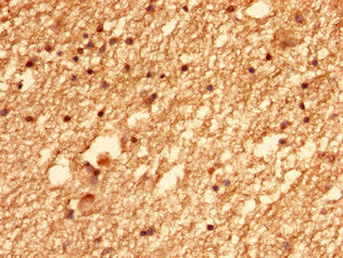 CEP126 Antibody